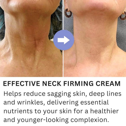 Verlina™ Anti-Age Neck Cream